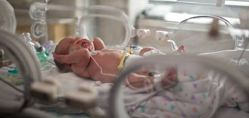 واکنش وزارت بهداشت درباره فوت نوزاد در بیمارستان