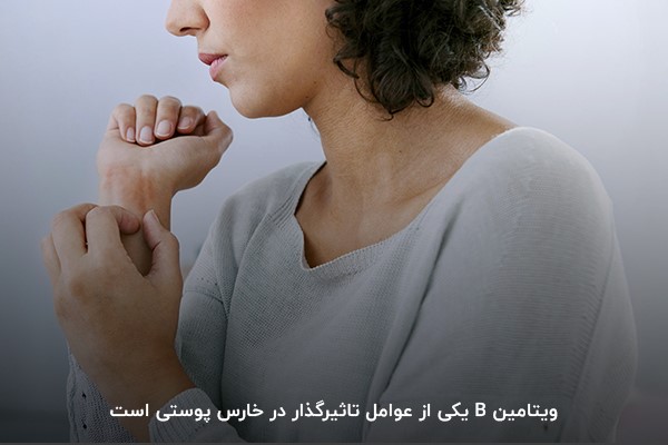 کمبود ویتامین B؛ یکی از دلایل خارش‌های پوستی
