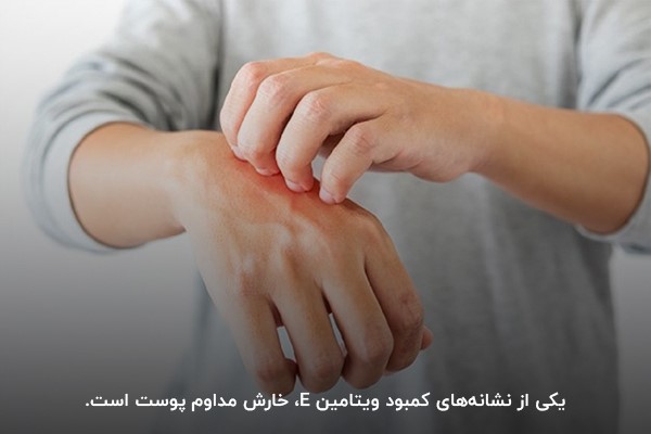 استفاده از مکمل ویتامین E‌ برای رفع خارش‌های پوستی