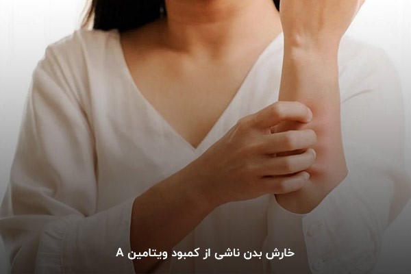    خارش بدن؛ یکی از نشانه‌های کاهش ویتامین A