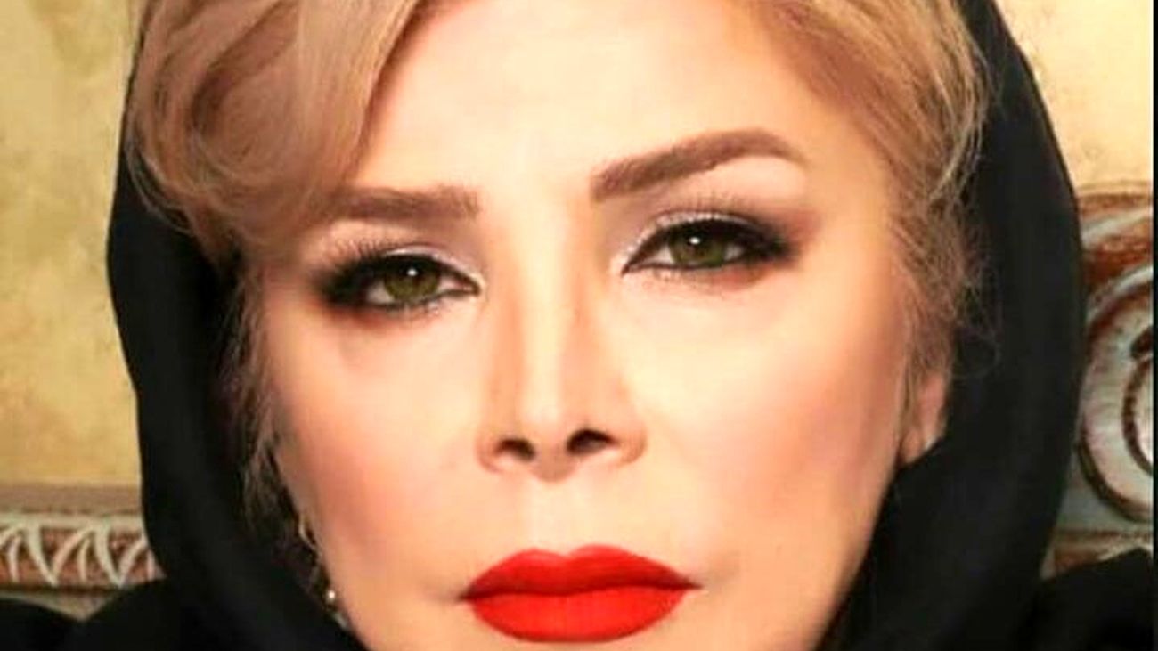 تغییر چهره شیوا خنیاگر با تزریق ژل و بوتاکس / 20 سال جوان شد !