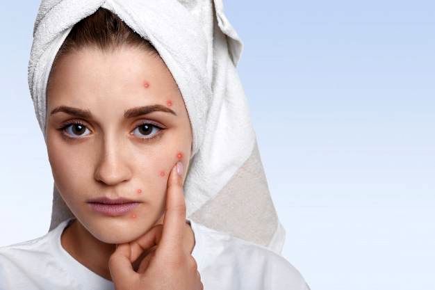 رفع جوش های قرمز