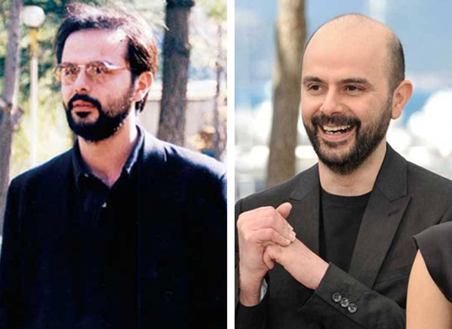 بازیگران مرد کچل
