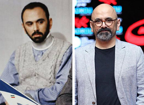 بازیگران مرد کچل