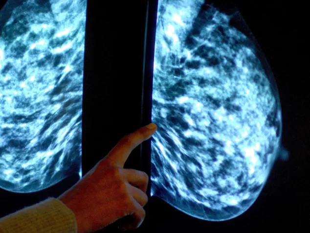 روش صحیح معاینه پستان‌ برای بررسی نشانه‌های هشداردهنده سرطان